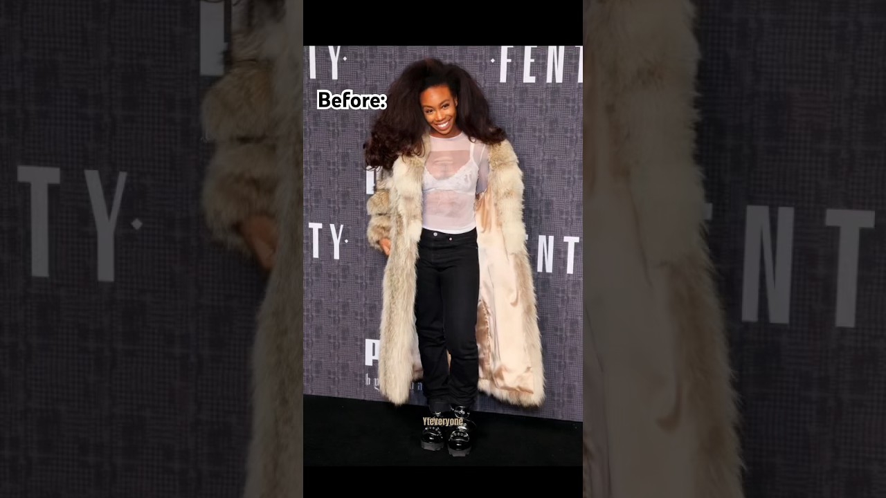 SZA before surgery #sza#before #after #famous#surgeon #singer #viral