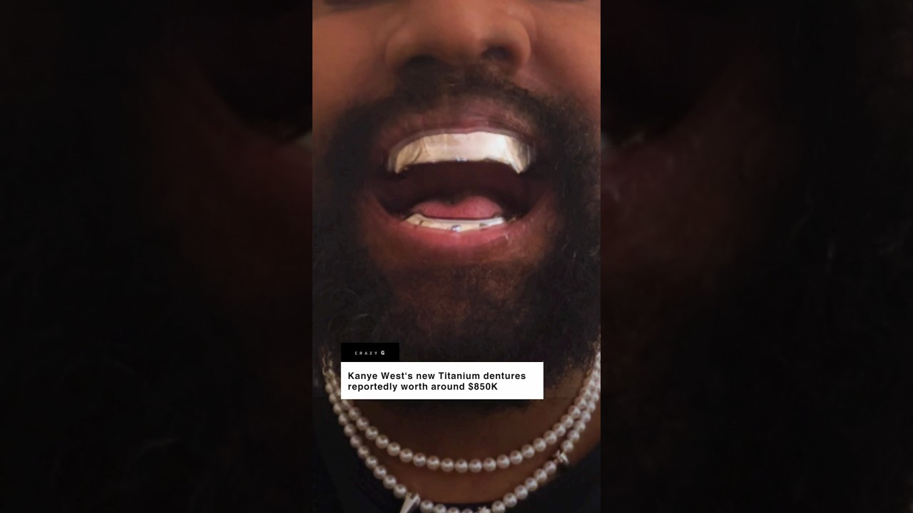 Kanye West gets Titanium TEETH #kanye #kanyewest #ye #vultures #shorts