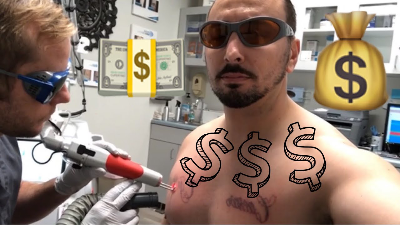 Laser Tattoo Removal COST 💰| HOW MUCH